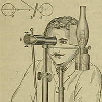 Grabado de un auto-oftalmoscopio